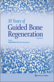 https://www.dentalbooks.org/wp-content/uploads/2021/12/30-Years-of-Guided-Bone-Regeneration-3rd-Edition-180x270.jpg