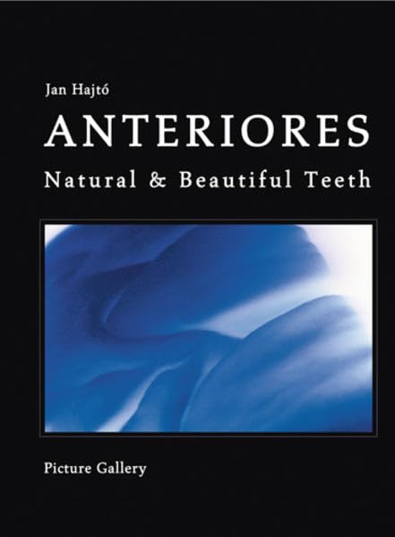 Anteriores natural beautiful teeth (PDF)