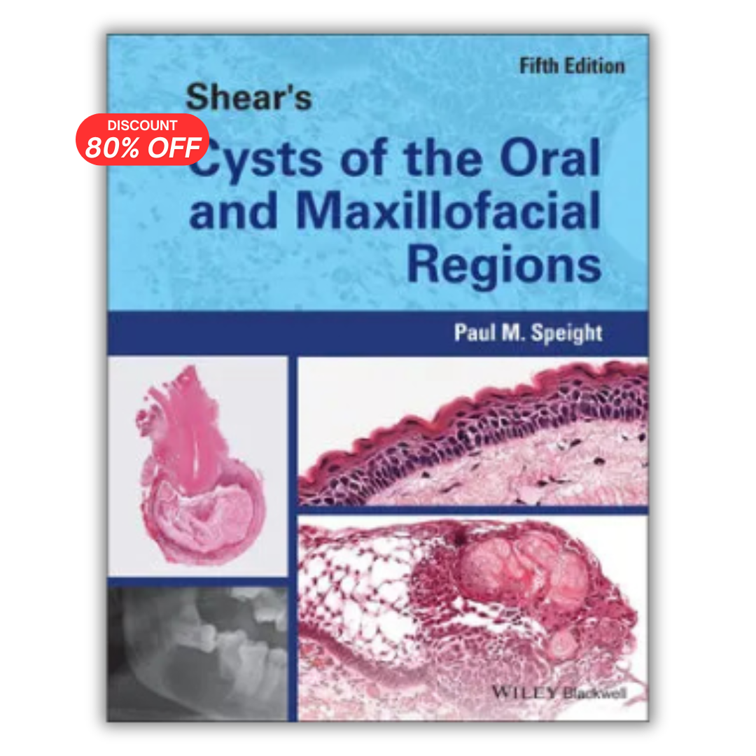 Shear’s Cysts of the Oral and Maxillofacial Regions, 5th Edition