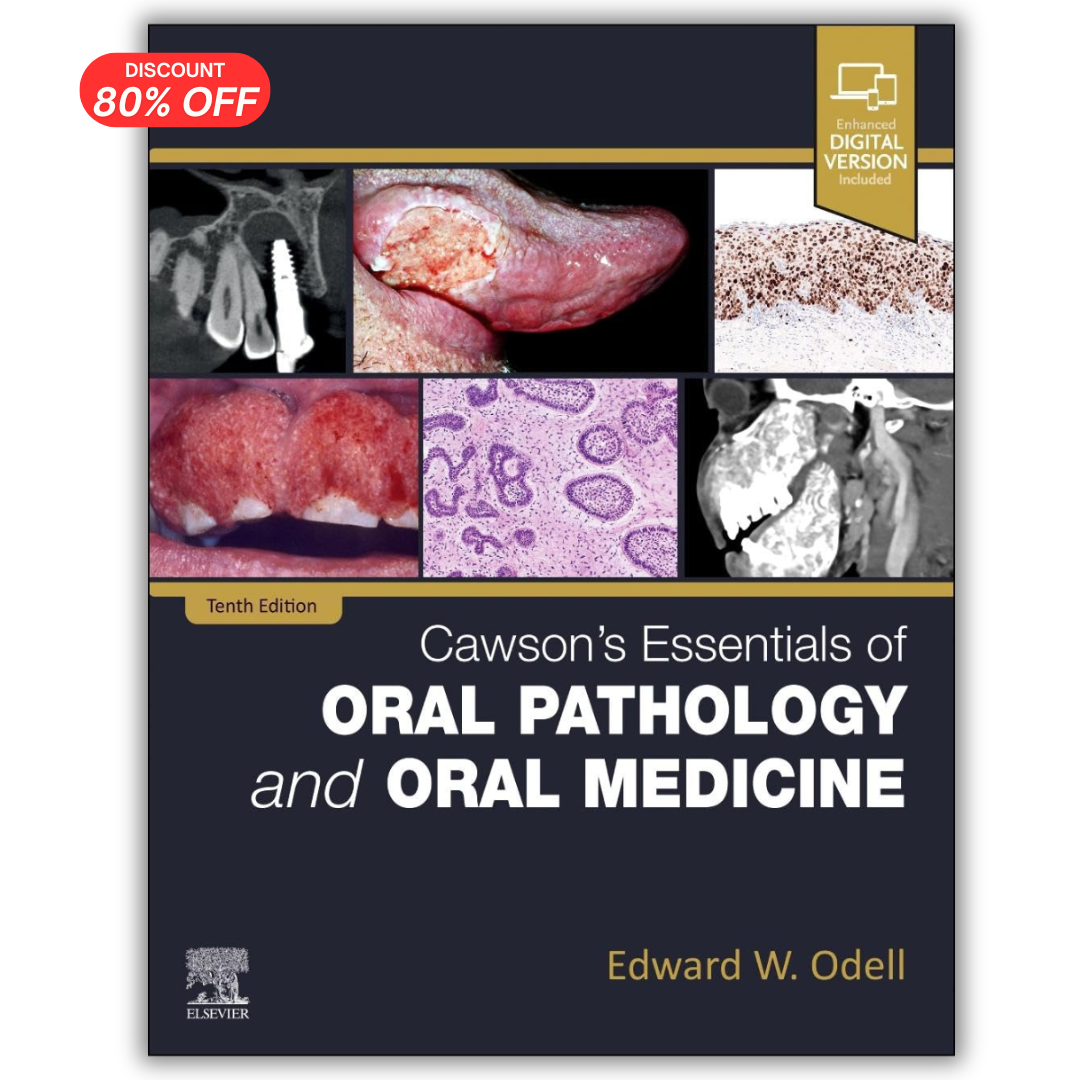 Cawson’s Essentials of Oral Pathology and Oral Medicine, 10th edition (True PDF)