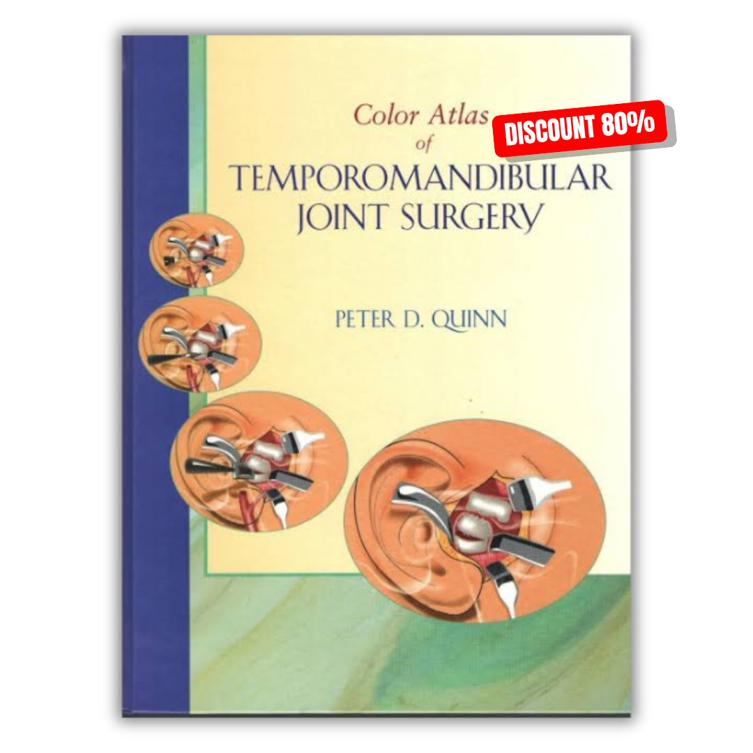 Color Atlas Of Temporomandibular Joint Surgery (PDF)