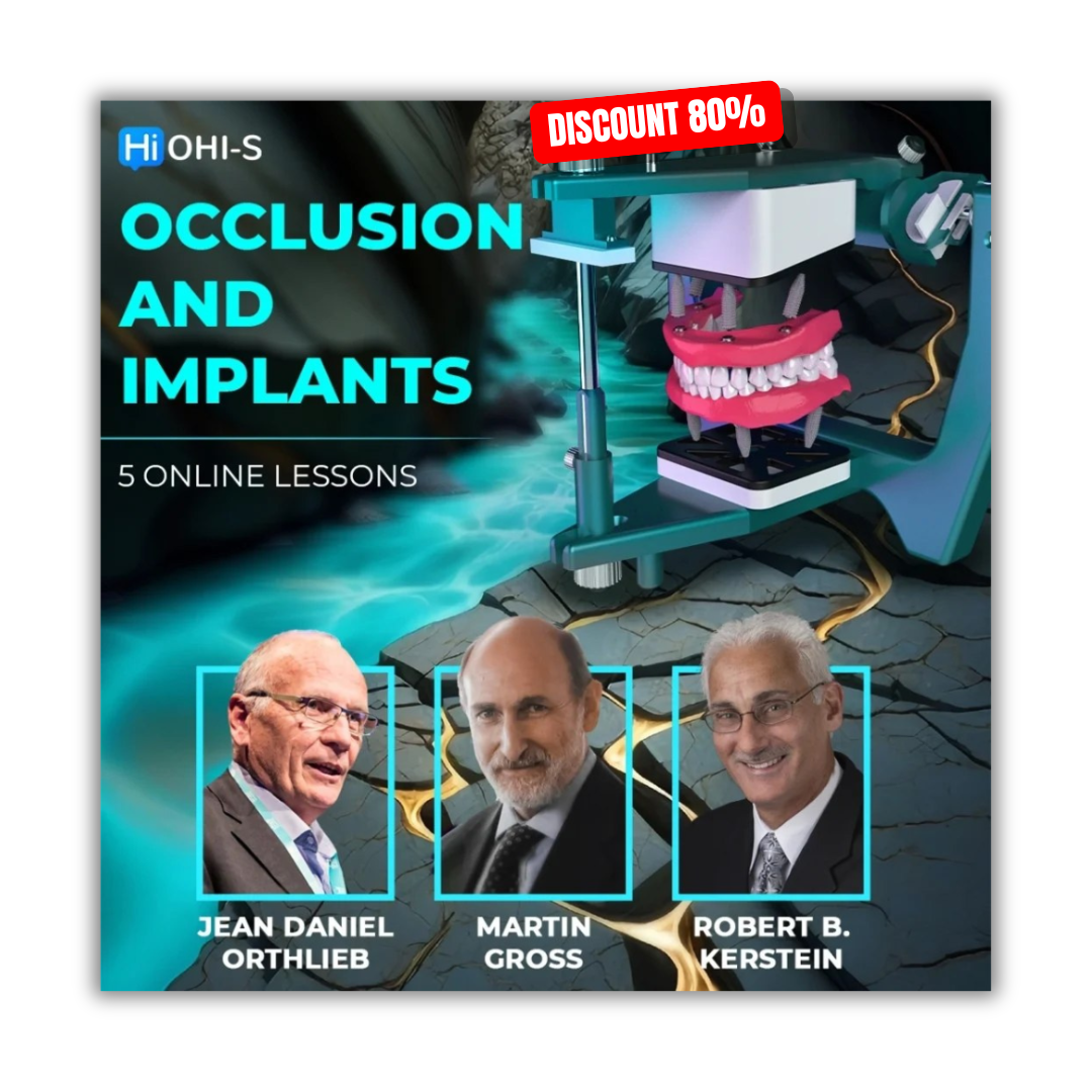 Occlusion and Implants