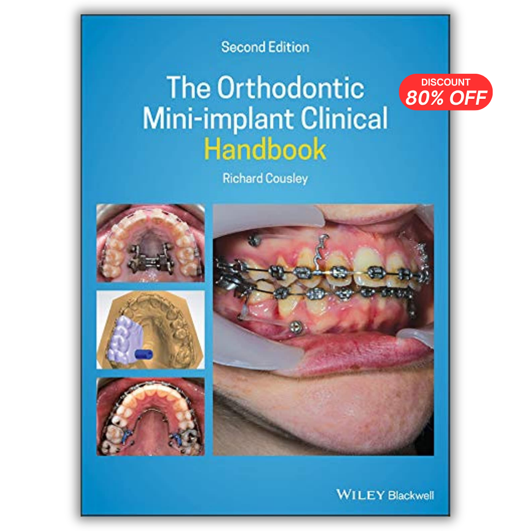 The Orthodontic Mini-implant Clinical Handbook 2nd Edition