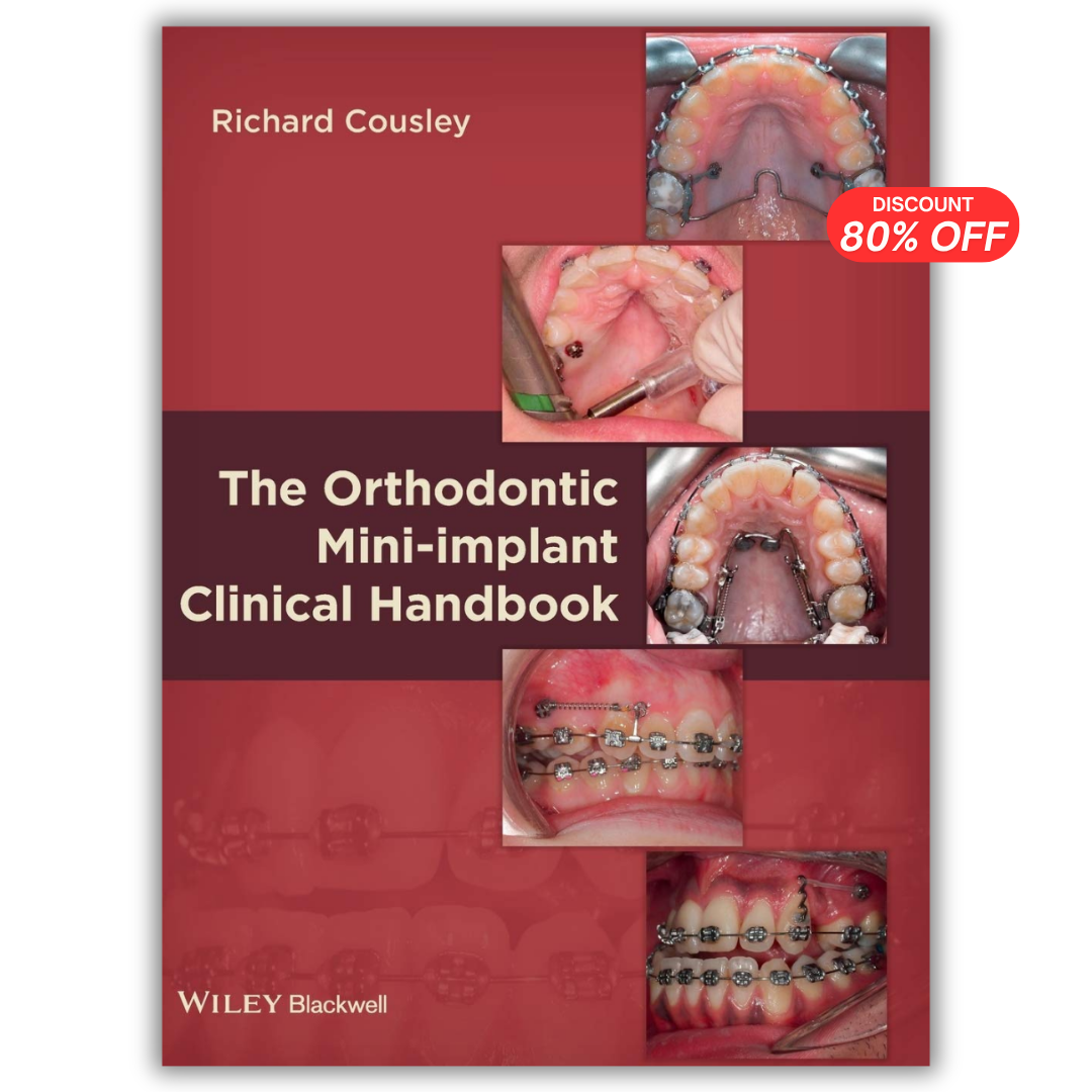 The Orthodontic Mini-implant Clinical Handbook