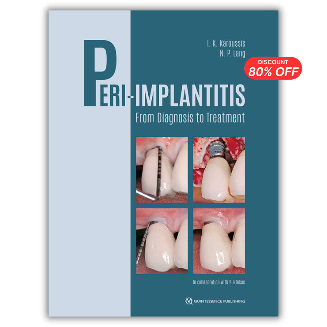 Peri-Implantitis: From Diagnosis to Treatment (PDF)