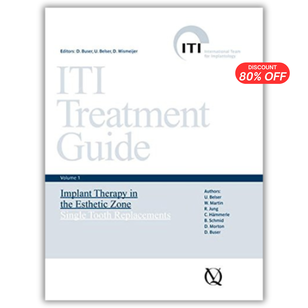 ITI Treatment Guide, Volume 1: Implant Therapy in the Esthetic Zone for Single-tooth Replacements (PDF)