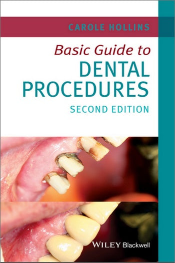 https://dentalmp4.com/wp-content/uploads/2021/03/Basic-Guide-to-Dental-Procedures-2nd-Edition.jpg