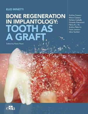 https://dental-books.com/wp-content/uploads/2023/08/Bone-regeneration-in-implantology_Tooth-as-a-Graft.jpg