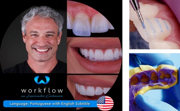 https://dentalmp4.com/wp-content/uploads/2024/01/Ceramic-Veneers-Workflow.jpg