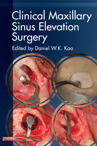 https://www.dentalbooks.org/wp-content/uploads/2019/02/Clinical-Maxillary-Sinus-Elevation-Surgery.jpg