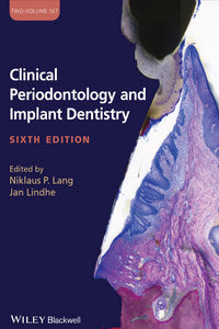 https://www.dentalbooks.org/wp-content/uploads/2019/03/Clinical-Periodontology-and-Implant-Dentistry-6th-edition.jpg