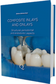 https://www.dentalbooks.org/wp-content/uploads/2020/09/Composite-Inlays-and-Onlays-180x270.png