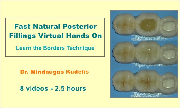 https://dentalmp4.com/wp-content/uploads/2023/03/Fast-Natural-Posterior-Fillings-Virtual-Hands-On.jpg