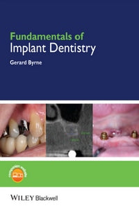 https://www.dentalbooks.org/wp-content/uploads/2019/02/Fundamentals-of-Implant-Dentistry.jpg