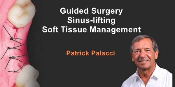 https://dentalmp4.com/wp-content/uploads/2023/06/Guided-Surgery-Sinus-lifting-Soft-Tissue-Management.jpg