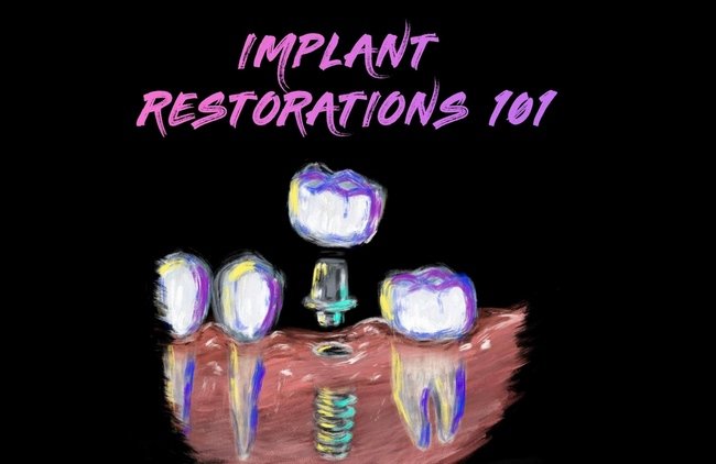 https://dentalmp4.com/wp-content/uploads/2023/08/Implant-Restorations-101.jpg