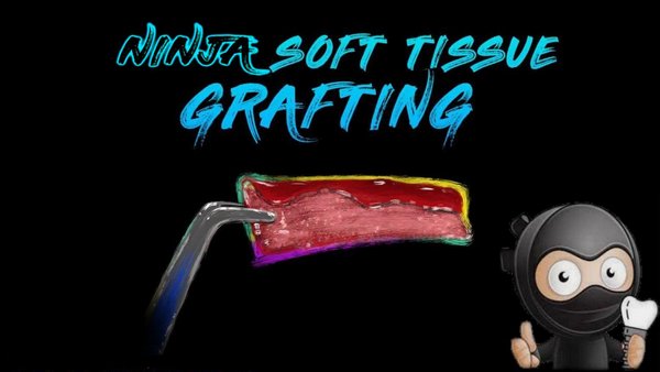 https://dentalmp4.com/wp-content/uploads/2023/09/Ninja-Soft-Tissue-Grafting.jpg