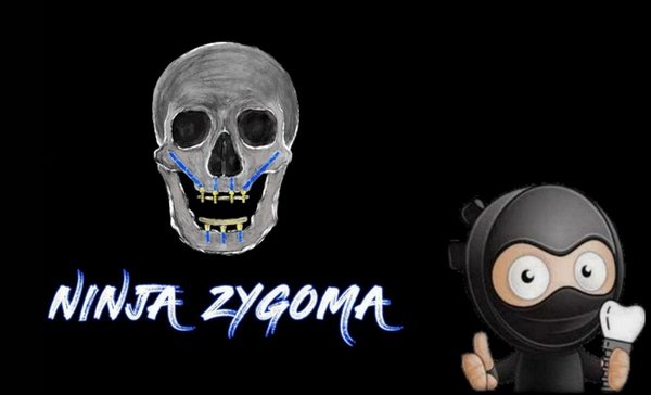 https://dentalmp4.com/wp-content/uploads/2023/09/Ninja-Zygoma-Course.jpg