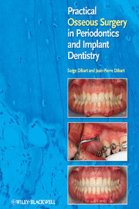 https://www.dentalbooks.org/wp-content/uploads/2019/02/PRACTICAL-OSSEOUS-SURGERY-IN-PERIODONTICS.jpg