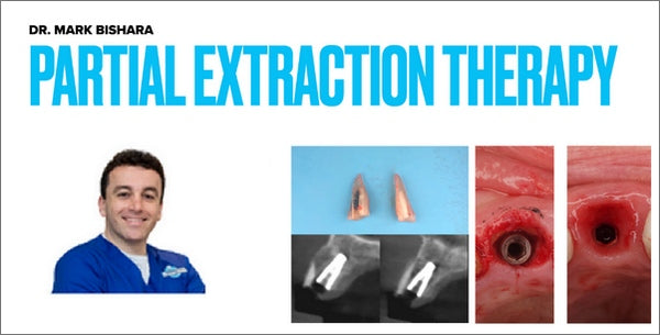 https://dentalmp4.com/wp-content/uploads/2022/10/Partial-Extraction-Therapy-Mark-Bishara.jpg