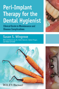 https://dental-library.net/wp-content/uploads/2019/02/Peri-Implant-Therapy-for-the-Dental-Hygienist.jpg