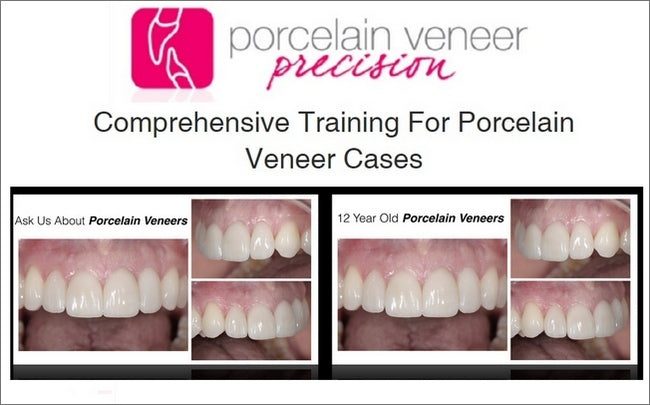 https://dentalmp4.com/wp-content/uploads/2023/08/Porcelain-Veneer-Precision-Comprehensive-Training-for-Porcelain-Veneer-Cases.jpg