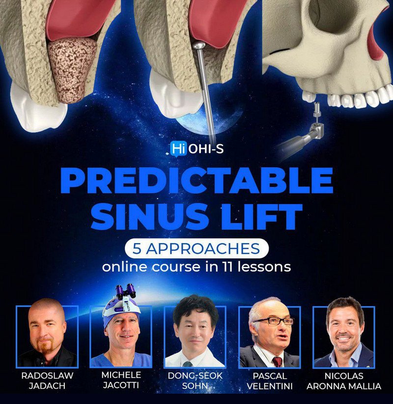 https://dentalmp4.com/wp-content/uploads/2024/04/Predictable-sinus-lift.jpg