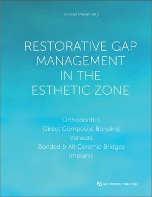 https://dentalmp4.com/wp-content/uploads/2023/05/Restorative-Gap-Management-in-the-Esthetic-Zone.jpg