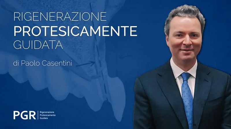 PGR Rigenerazione Protesicamente Guidata (Italian Language with English Subtitles)