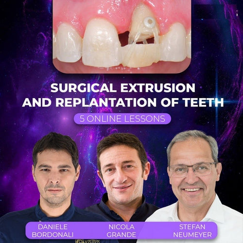 https://dental-books.com/wp-content/uploads/2023/12/Surgical-Extrusion-and-Replantation-of-Teeth.jpg