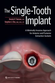 https://www.dentalbooks.org/wp-content/uploads/2019/11/he-Single-Tooth-Implant-180x270.jpg