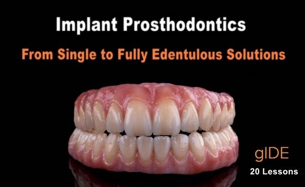 Implant Prosthodontics – From Single to Fully Edentulous Solutions