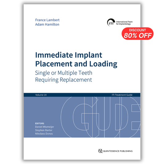 Immediate Implant Placement and Loading ( ITI Treatment Guide, Volume 14)