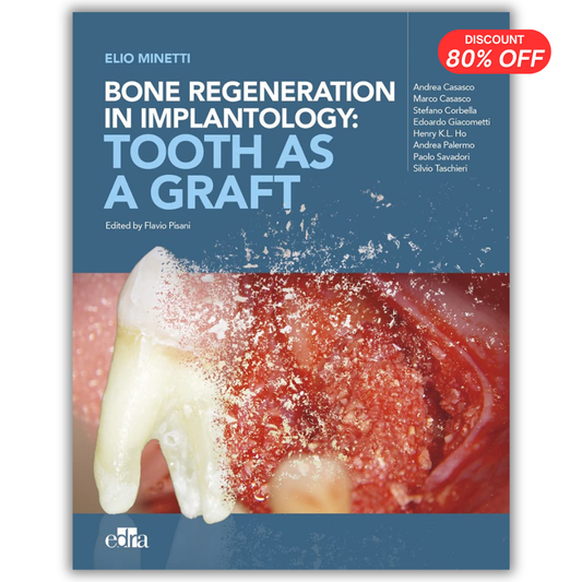 Bone Regeneration in Implantology: Tooth as a Graft