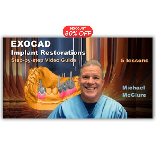 EXOCAD Implant Restorations: Step-by-step Video Guide