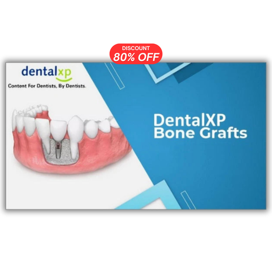 Vertical & Horizontal Bone Grafts (238 Lectues Collection)