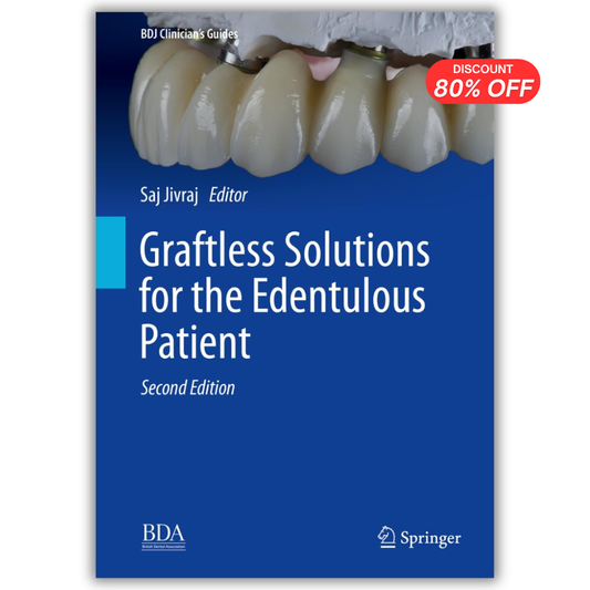 Graftless Solutions for the Edentulous Patient, 2nd Edition