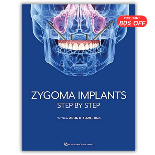 Zygoma Implants: Step by Step