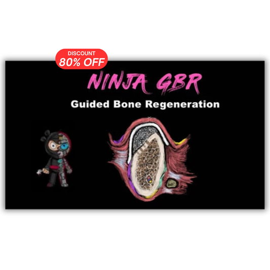 Implant Ninja, Guided Bone Regeneration