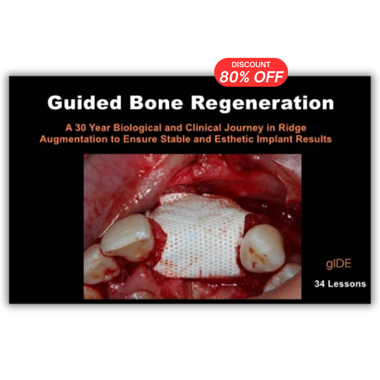 Guided Bone Regeneration: A 30 year Biological and Clinical Journey in Ridge Augmentation