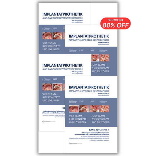 Implant-Supported Restorations – Vol. 1- 4 – (Video Course)