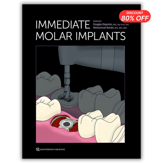 Immediate Molar Implants