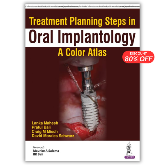 Treatment Planning Steps in Oral Implantology: A Color Atlas