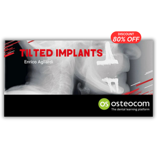 Tilted Implants: A Complete Surgical and Theoretical Guide to Tilted Implants