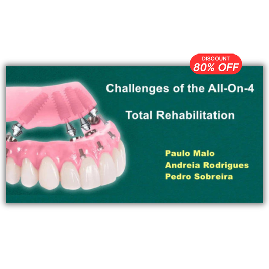 Сhallenges of the All-On-4 Total Rehabilitation