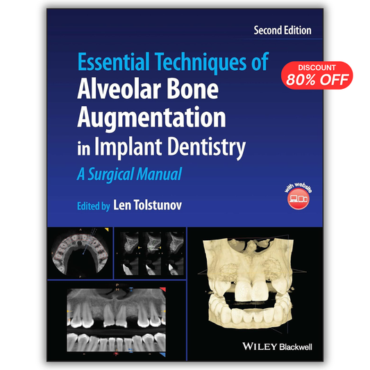 Essential Techniques of Alveolar Bone Augmentation in Implant Dentistry: A Surgical Manual, 2nd Edition