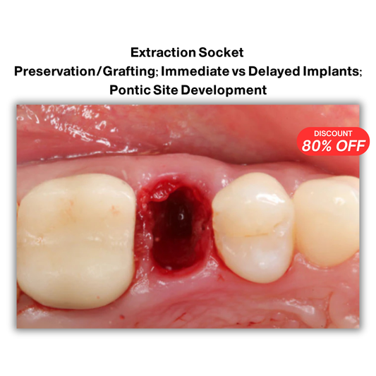 Extraction Socket – Preservation/Grafting; Immediate vs Delayed Implants; Pontic Site Development