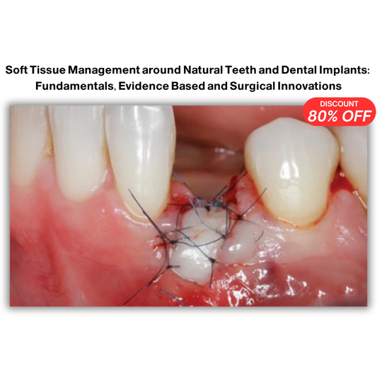 Soft Tissue Management around Natural Teeth and Dental Implants: Fundamentals, Evidence Based and Surgical Innovations