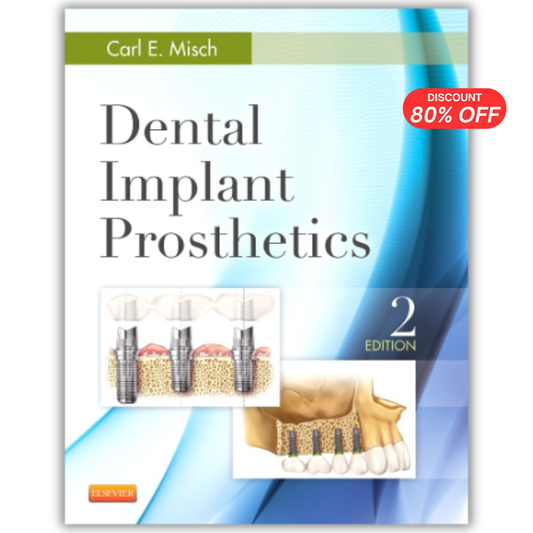 Dental Implant Prosthetics, 2nd Edition