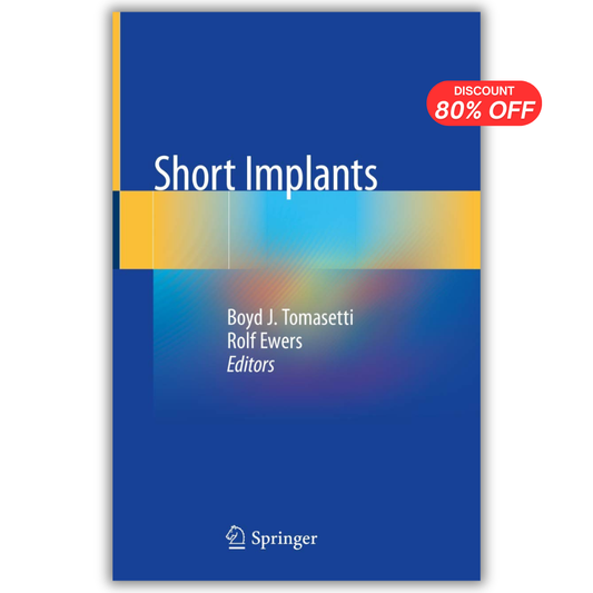 Short Implants